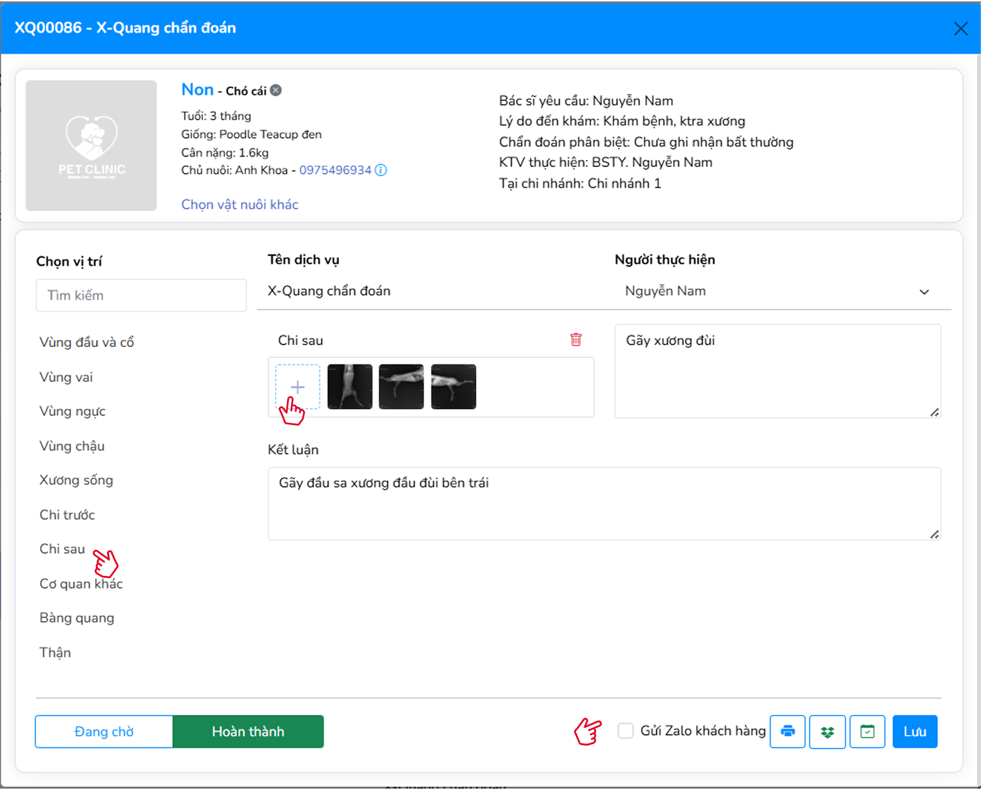Thực hiện hoặc cập nhật phiếu X-Quang
